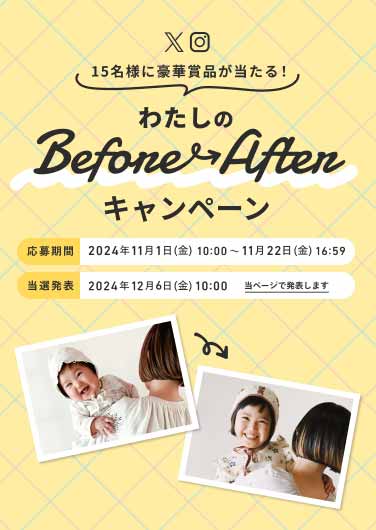 わたしのBeforeAfterキャンペーン！豪華商品が当たるチャンス #しまうまプリント ハッシュタグをつけて投稿しよう！